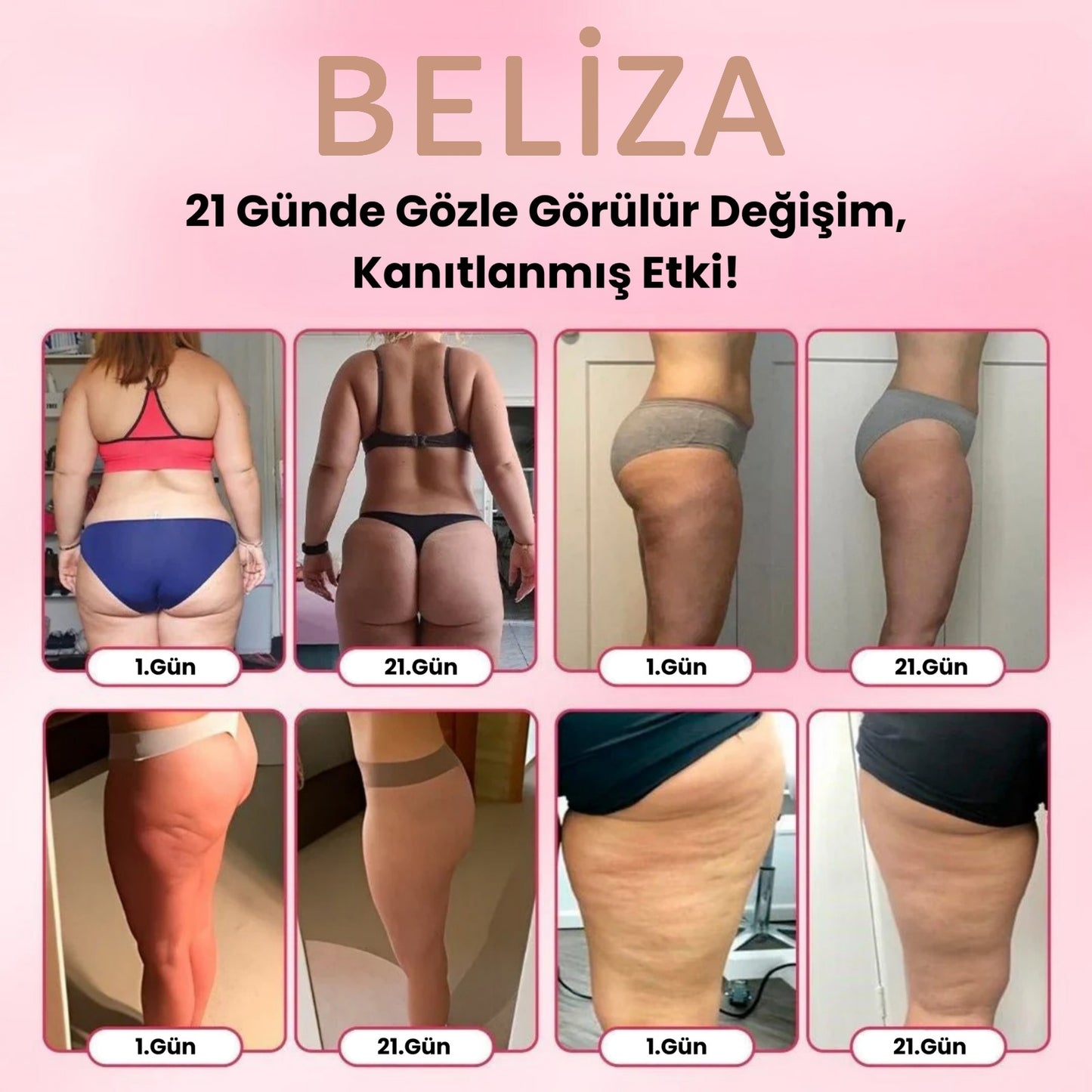 Selülit Giderici Sıkılaştırıcı/İnceltici Masaj Aleti