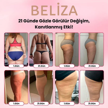 Selülit Giderici Sıkılaştırıcı/İnceltici Masaj Aleti